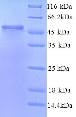 Human LMAN1L Protein (Recombinant His)