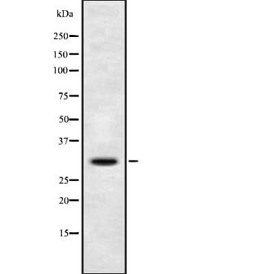 DIO3 Antibody