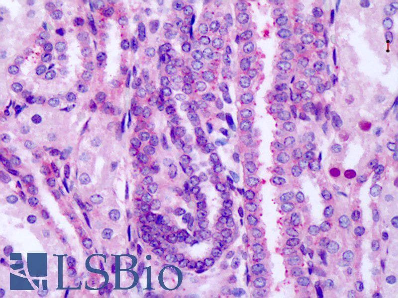 IHC-plus™ Polyclonal Rabbit anti-Human FZD8 / Frizzled 8 Antibody (Extracellular Domain, IHC)