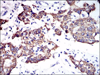KRT5 / CK5 / Cytokeratin 5 Antibody (aa316-590, clone 10C11E6)