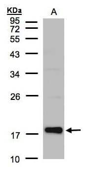 CFL2 / Cofilin 2 Antibody (aa92-166)
