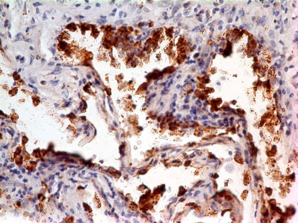 NAPSA / NAPA / Napsin A Antibody