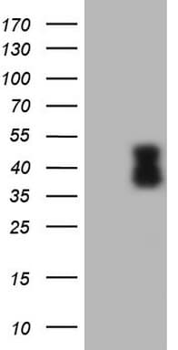 TFPI / LACI Antibody (aa29-304, clone OTI3C2)