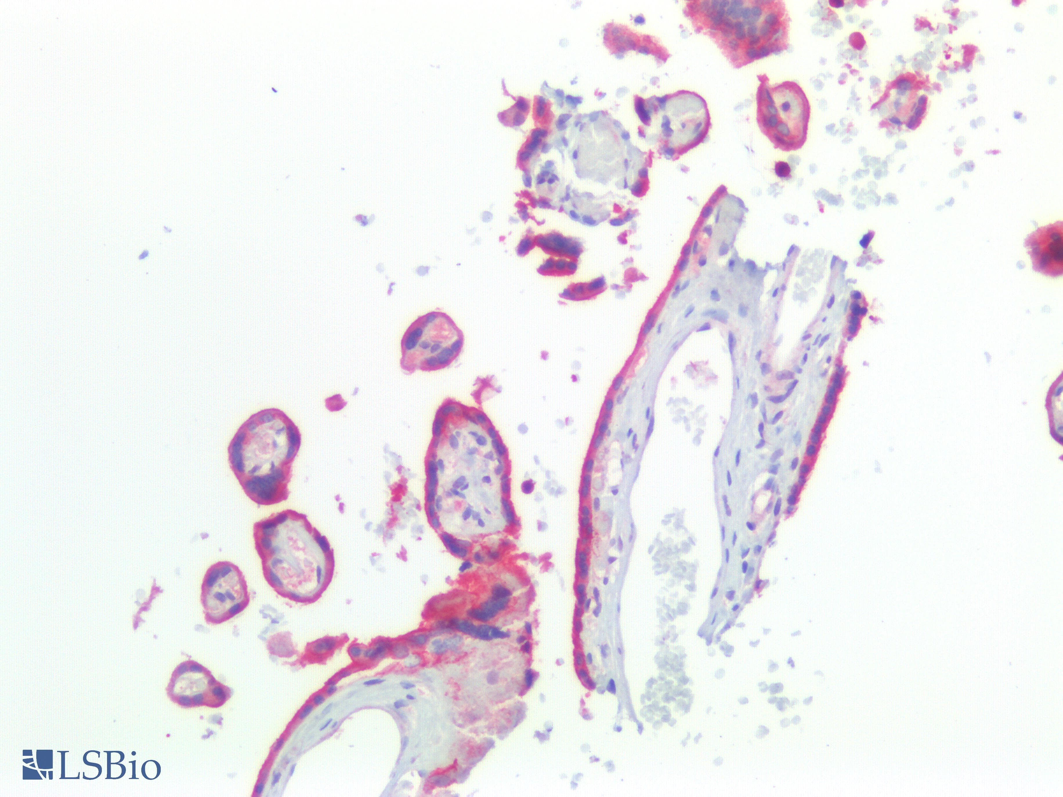 IHC-plus™ Polyclonal Rabbit anti-Human EGFR Antibody (C-Terminus, IHC, IF, WB)