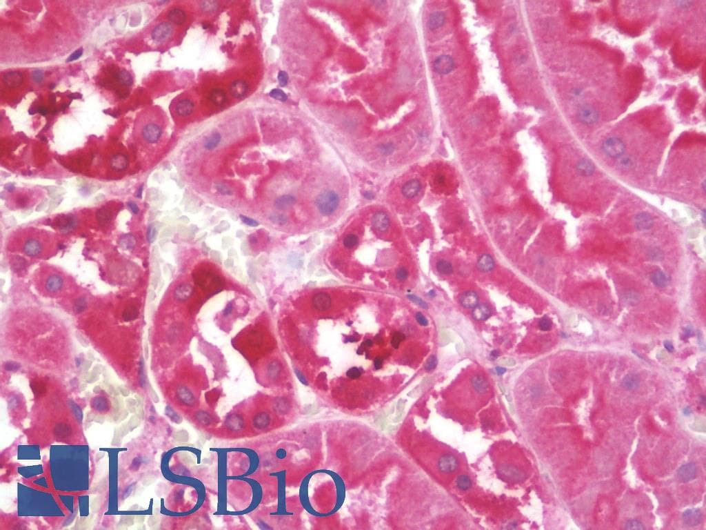 PathPlus™ BRAF / B-Raf Antibody