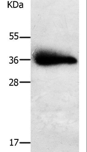 PAP2a / PPAP2A Antibody