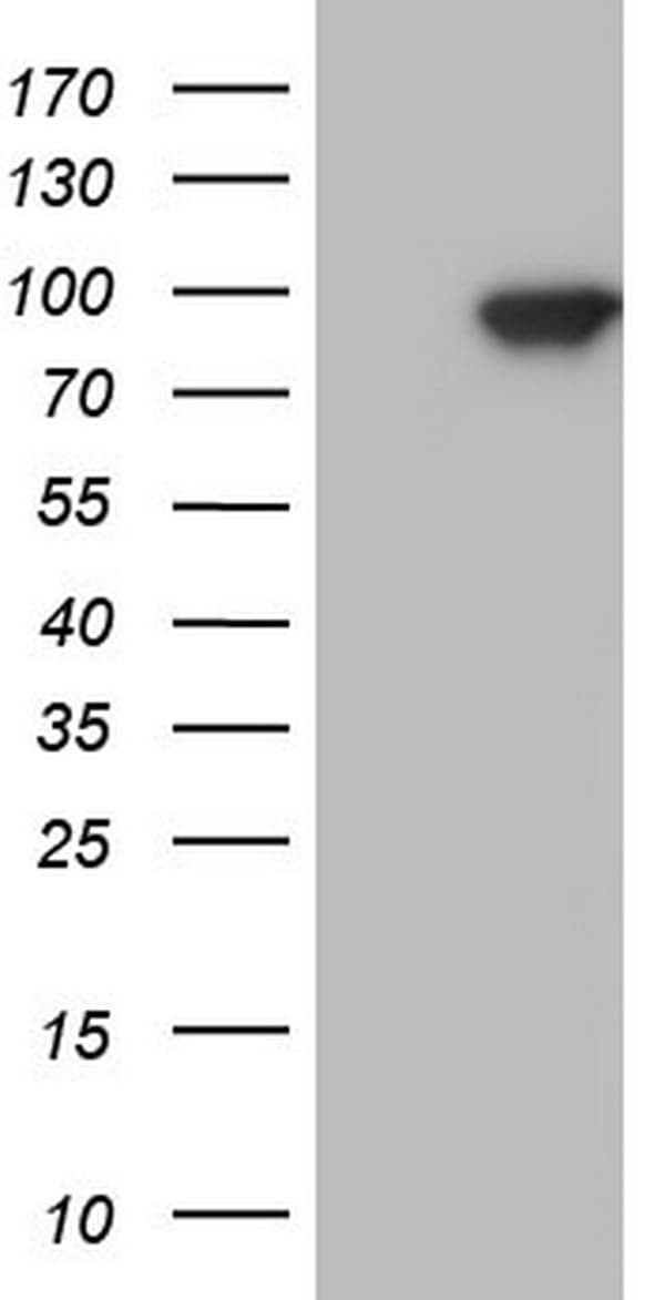 TLK2 Antibody (aa1-296, clone OTI2E10)