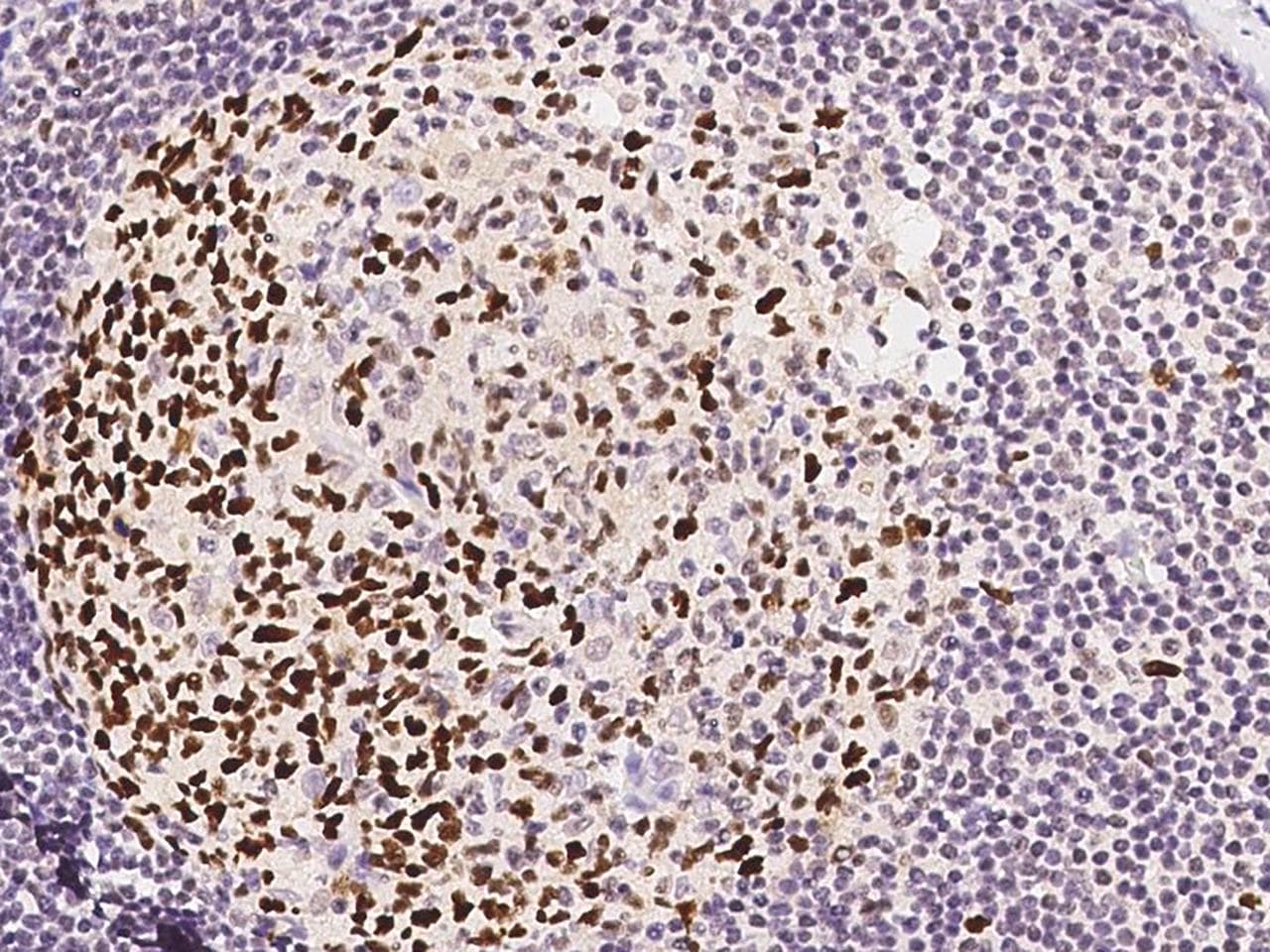 LIG1 / DNA Ligase 1 Antibody