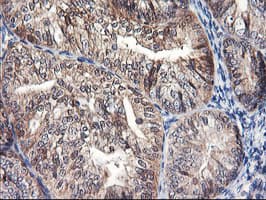 FBXO21 Antibody (clone OTI3C11, Carrier-free)