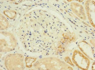 Polyclonal Rabbit anti-Human CACNA1H / Cav3.2 Antibody (IHC, IF)