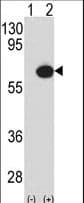 Polyclonal Rabbit anti-Human TAB1 Antibody (aa416-445, WB)