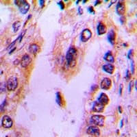 Recoverin Antibody (Internal)