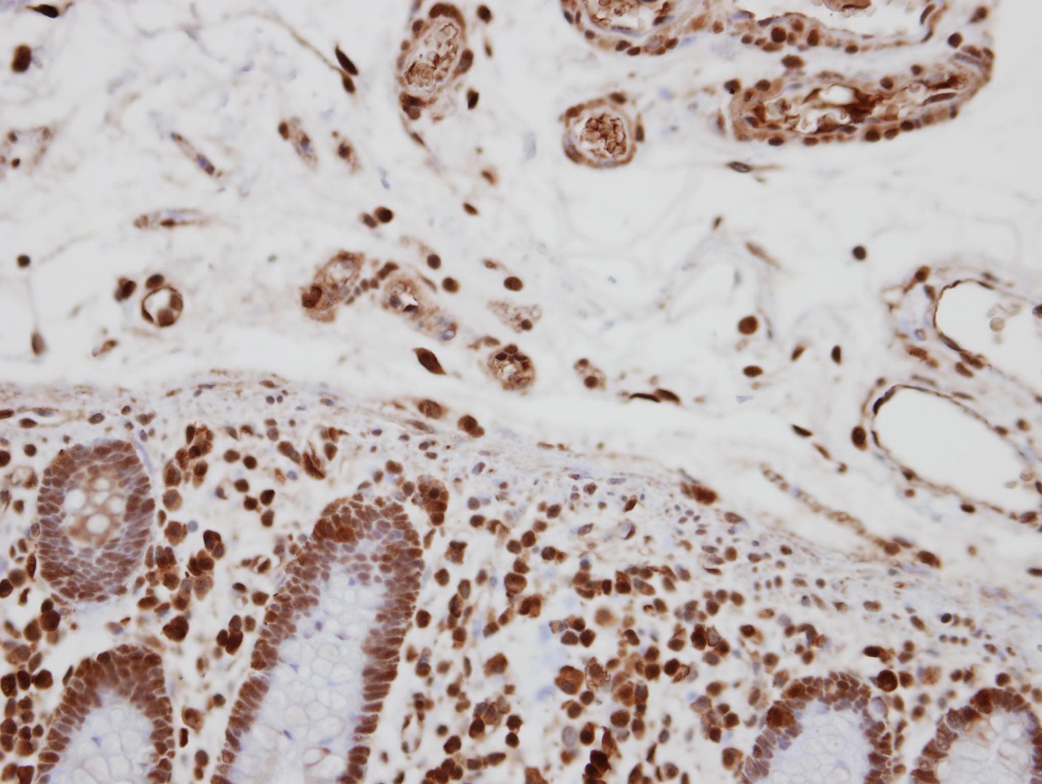 TCERG1 / CA150 Antibody