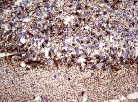 Vimentin Antibody (clone OTI5C10)
