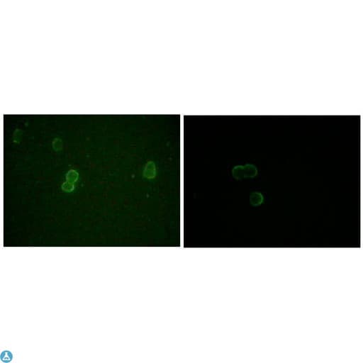 APOM / Apolipoprotein M Antibody