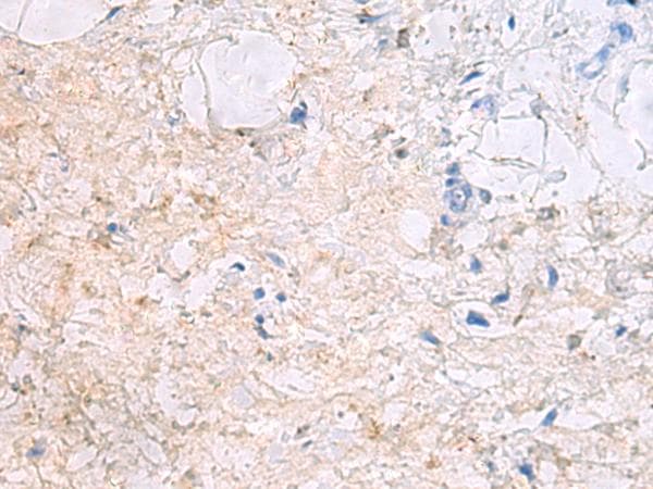 DPCD Antibody