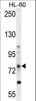 ALDP / ABCD1 Antibody (aa257-285)