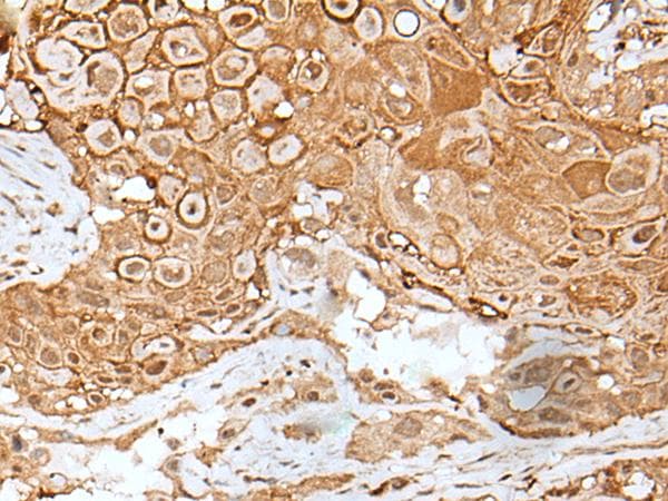 IL6ST / CD130 / gp130 Antibody