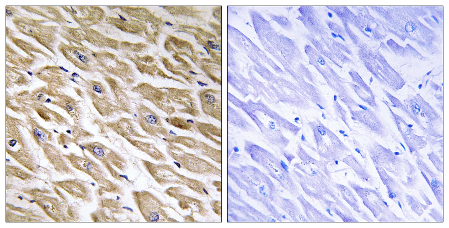 Polyclonal Rabbit anti-Human MRPL39 Antibody (aa289-338, IHC, WB)