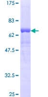 Human RAD51B Protein (Recombinant GST)