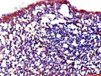 IL23R Antibody