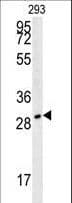 Polyclonal Rabbit anti-Human TPSAB1 / Mast Cell Tryptase Antibody (aa61-87, WB)