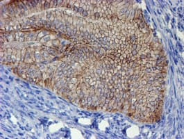 ERBB2 / HER2 Antibody (aa676-1255, clone OTI11A7, Carrier-free)