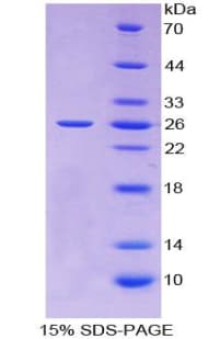 Human TIMP3 Protein (Recombinant His-T7)