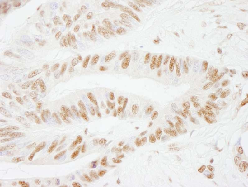 CSTF2 / CstF-64 Antibody (aa375-425)