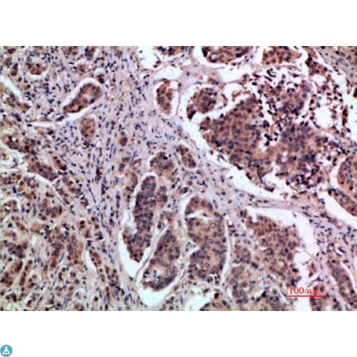 TFF1 / pS2 Antibody