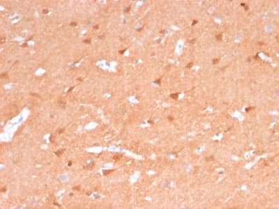 UCHL1 / PGP9.5 Antibody (clone rUCHL1/775)