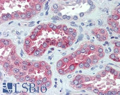 IHC-plus™ NPR3 Antibody