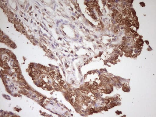 Monoclonal Mouse anti-Human HnRNP-E1 / PCBP1 Antibody (clone OTI3D12, aa1-225, IHC, WB)