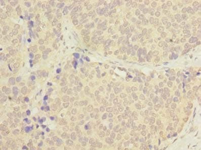 Polyclonal Rabbit anti-Human C1orf182 Antibody (IHC)