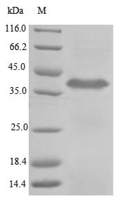 Crab-eating macaque TPBG / 5T4 Protein (Recombinant 10His, N-terminus + Myc, C-terminus)