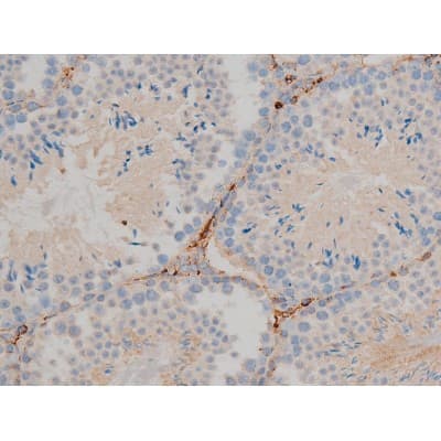 Polyclonal Rabbit anti-Human BCL2 / Bcl-2 Antibody (phospho-Ser70, IHC, IF, WB)