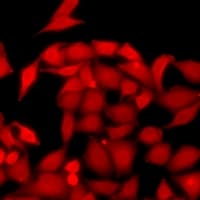 RENT1 / UPF1 Antibody