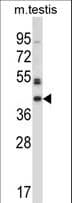 POMK / SGK196 Antibody (aa245-273)