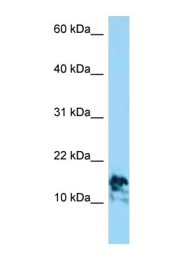 LAMA4 / Laminin Alpha 4 Antibody (aa65-114)
