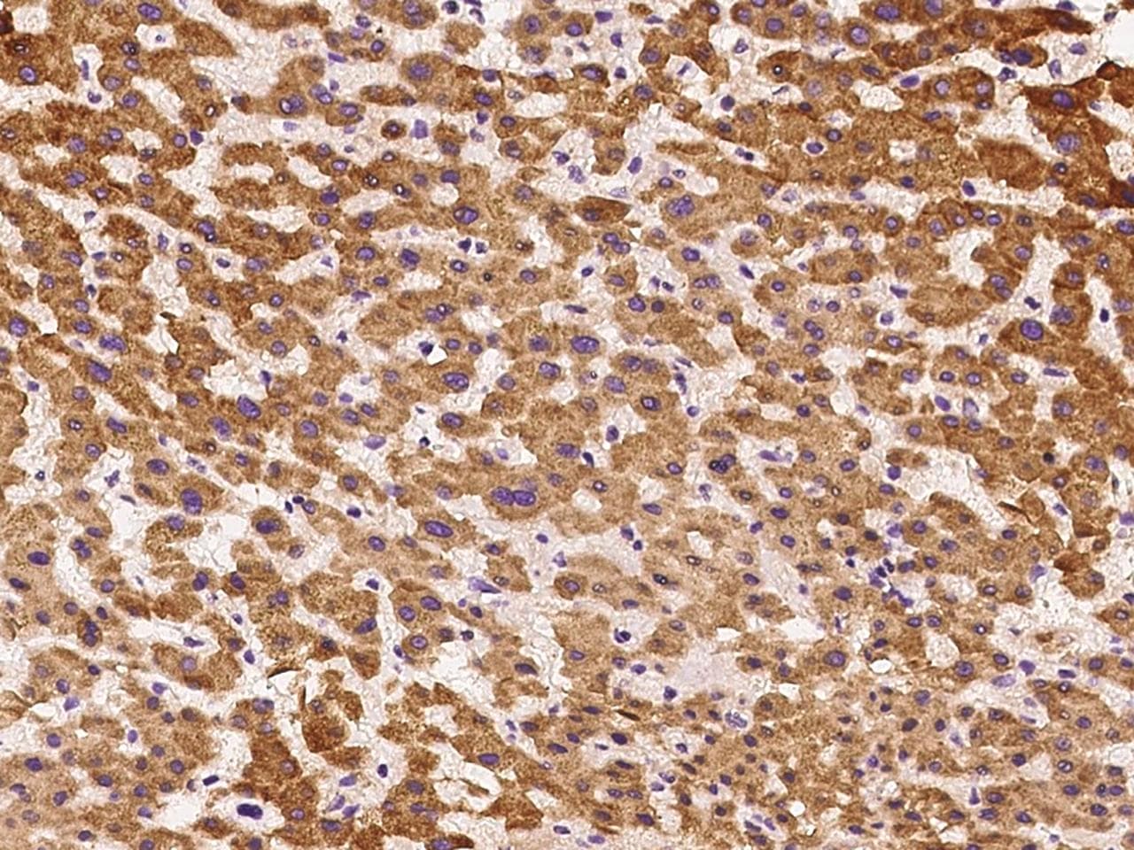 Polyclonal Rabbit anti-Human CYPOR / POR Antibody (IHC, WB)