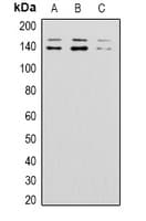 ADGRB1 / BAI1 Antibody