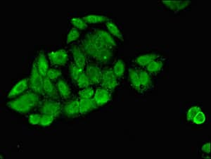 Polyclonal Rabbit anti-Human SLC25A1 / SEA Antibody (IHC, IF)