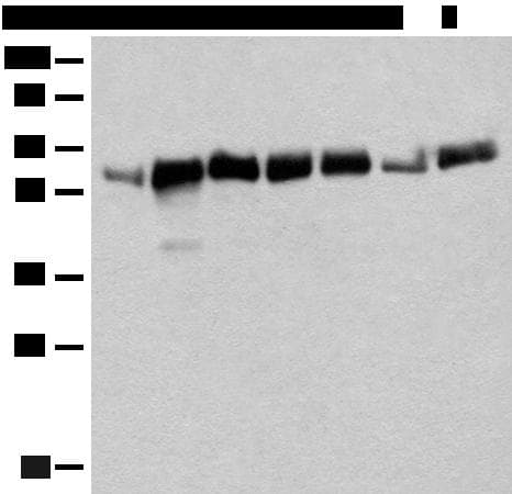 Polyclonal Rabbit anti-Human CCDC47 Antibody (IHC, WB)