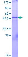 Human UBE2U Protein (Recombinant GST)