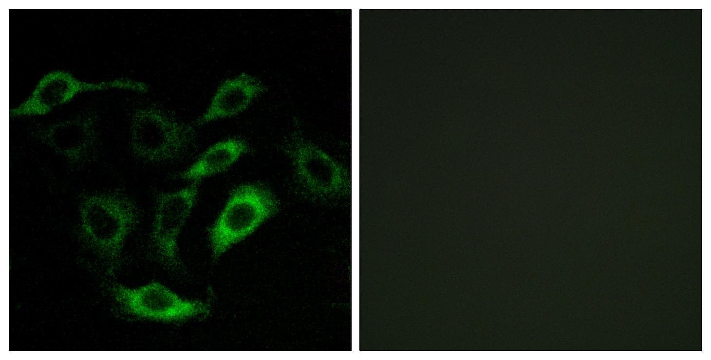 Polyclonal Rabbit anti-Human Prostaglandin D2 Receptor Antibody (IF, WB)