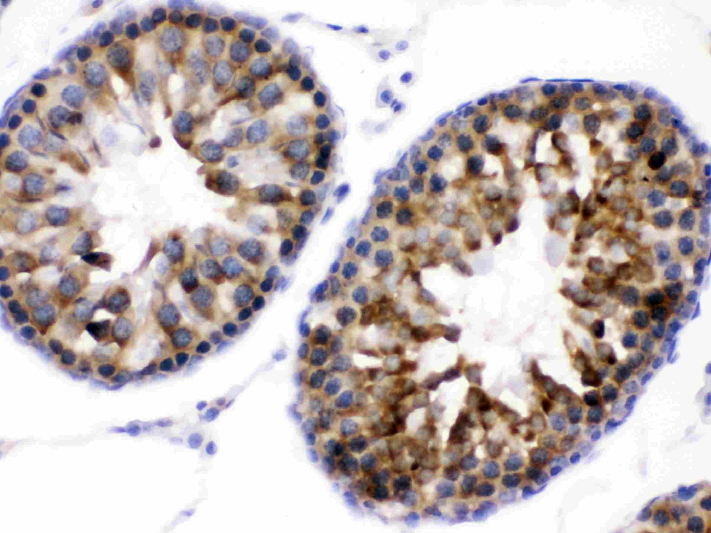 Polyclonal Rabbit anti-Human WNK1 Antibody (IHC, WB)
