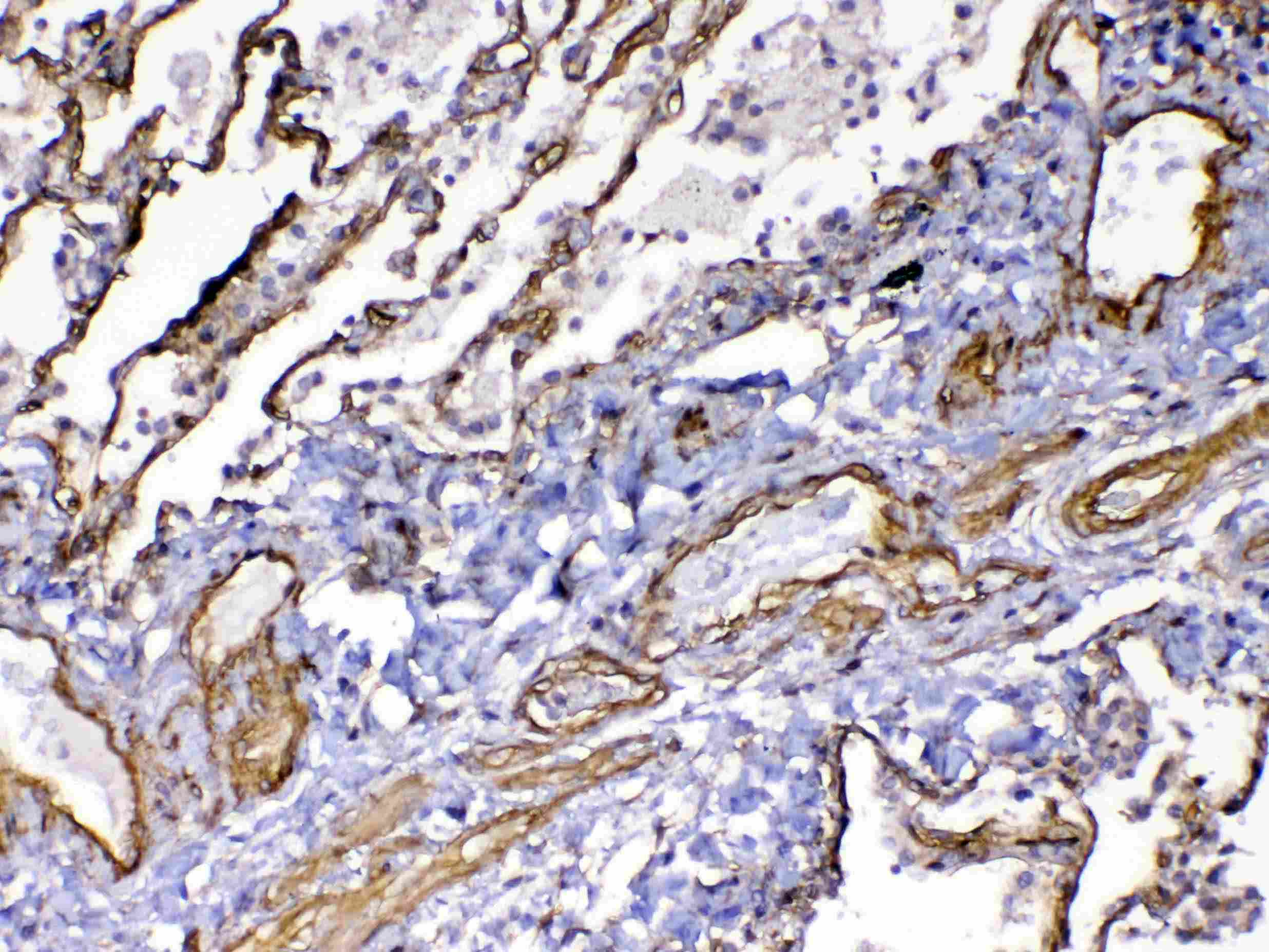 FLT4 / VEGFR3 Antibody
