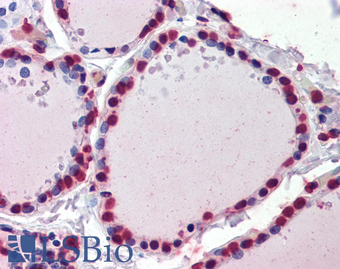 IHC-plus™ Monoclonal Mouse anti-Human CRABP1 / CRABP Antibody (clone AT1A1, IHC, WB)
