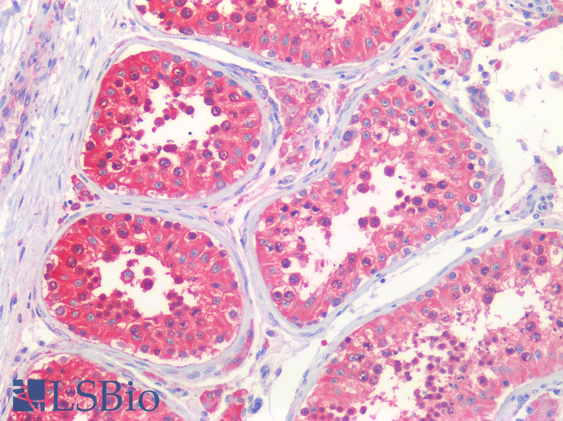 IHC-plus™ HSPA5 / GRP78 / BiP Antibody (clone 1672CT323.22.82)