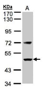 IHC-plus™ Polyclonal Rabbit anti-Human F7 / Factor VII Antibody (IHC, WB)